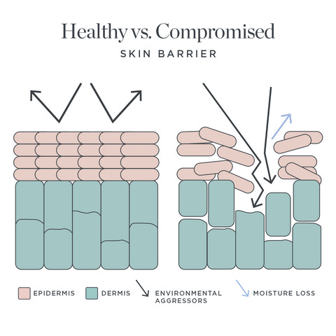 How To Prevent Transepidermal Water Loss