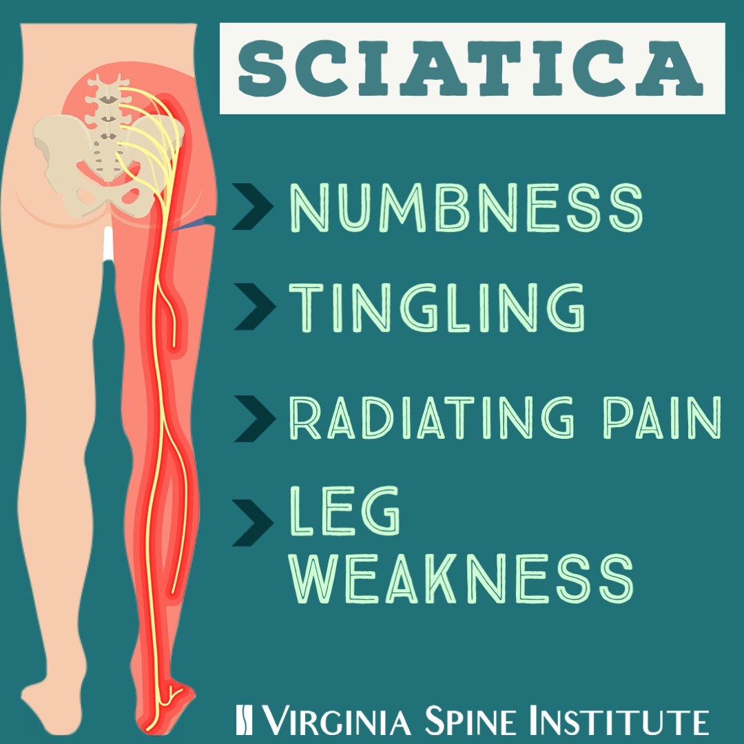 How Physical Therapy Can Jumpstart Your Sciatica Treatment