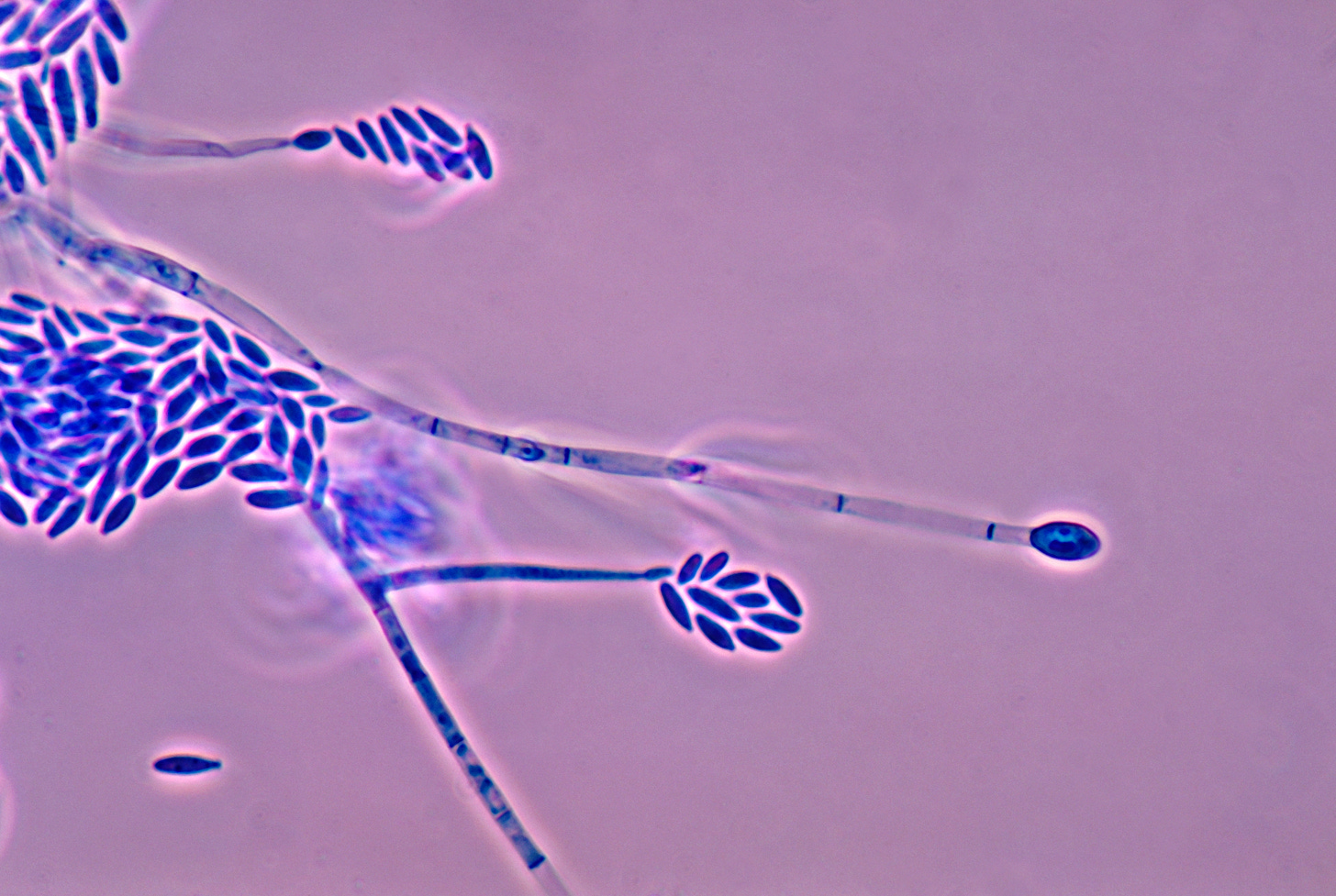 Fusarium - Wikipedia