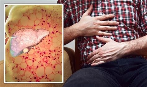 Fatty liver disease: Symptoms may include forgetfulness and brain fog ... Fatty liver disease: Symptoms may include forgetfulness and brain fog ...