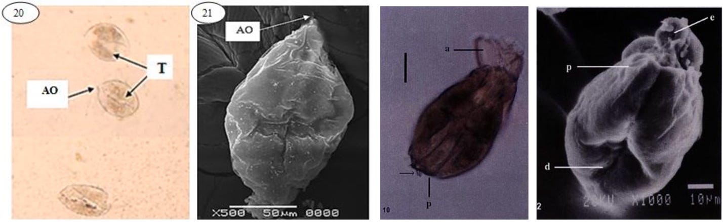 Light and electron micrographs of lasidia. Light and electron micrographs of lasidia.