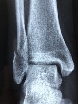 Radiography, Diagnosis, Anatomy, Injury