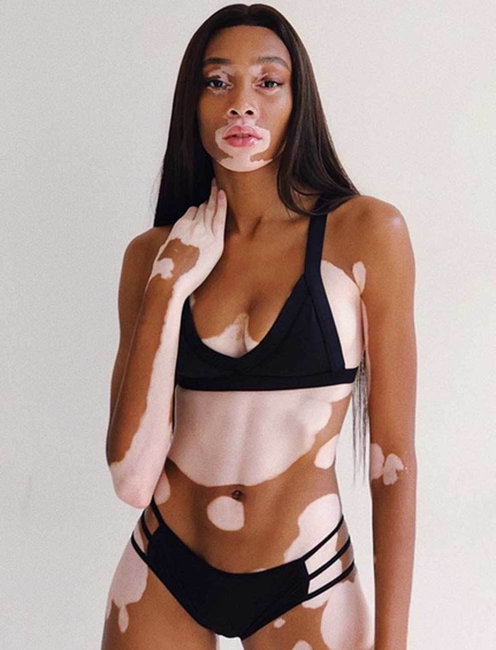 NBA: Winnie harlow | MARCA.com