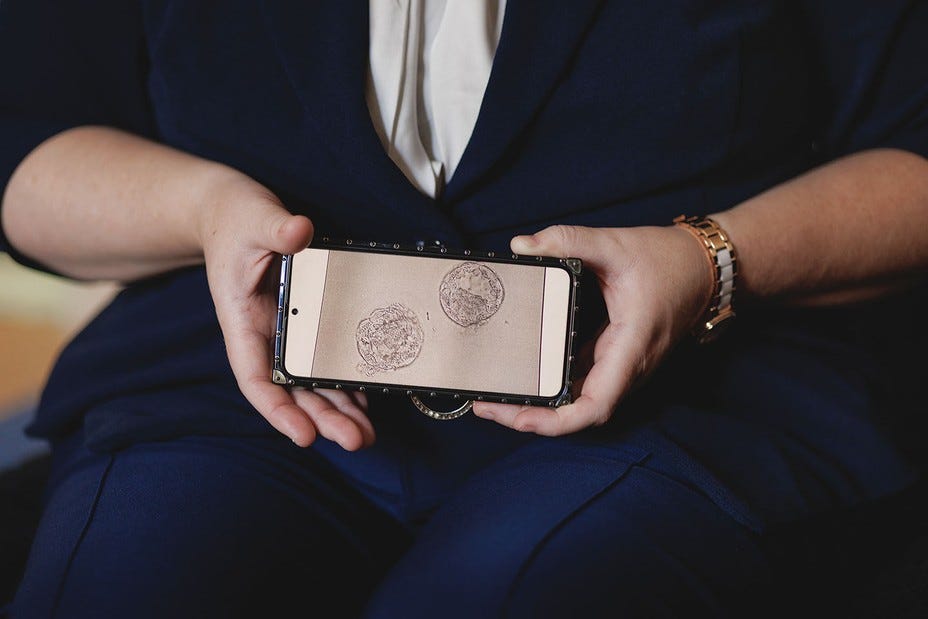 photo of woman's hands holding phone with image of two embryos as cells photo of woman's hands holding phone with image of two embryos as cells