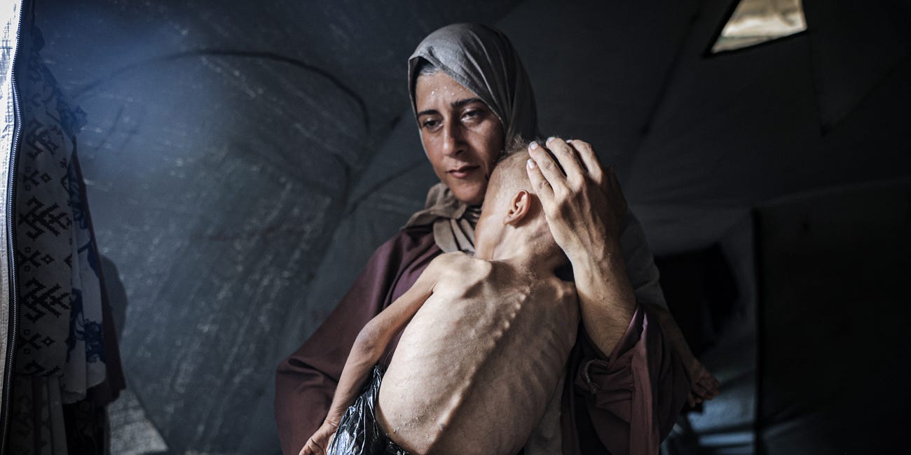 More Babies Will Have Starved to Death in Gaza By the Time You Read This Essay