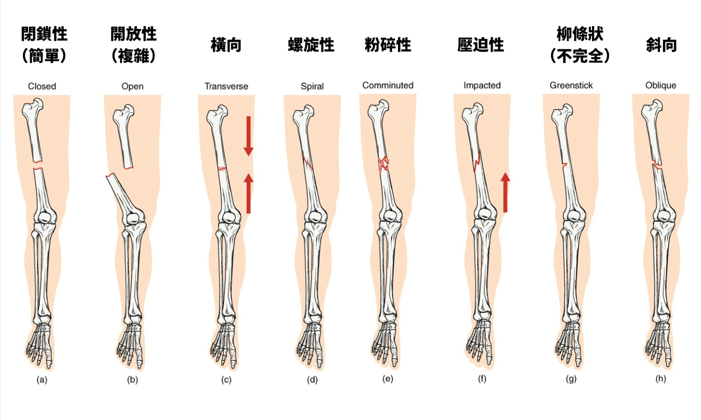 一張含有 骨骼, 連接器 的圖片
AI 產生的內容可能不正確。 一張含有 骨骼, 連接器 的圖片
AI 產生的內容可能不正確。