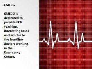 EMECG