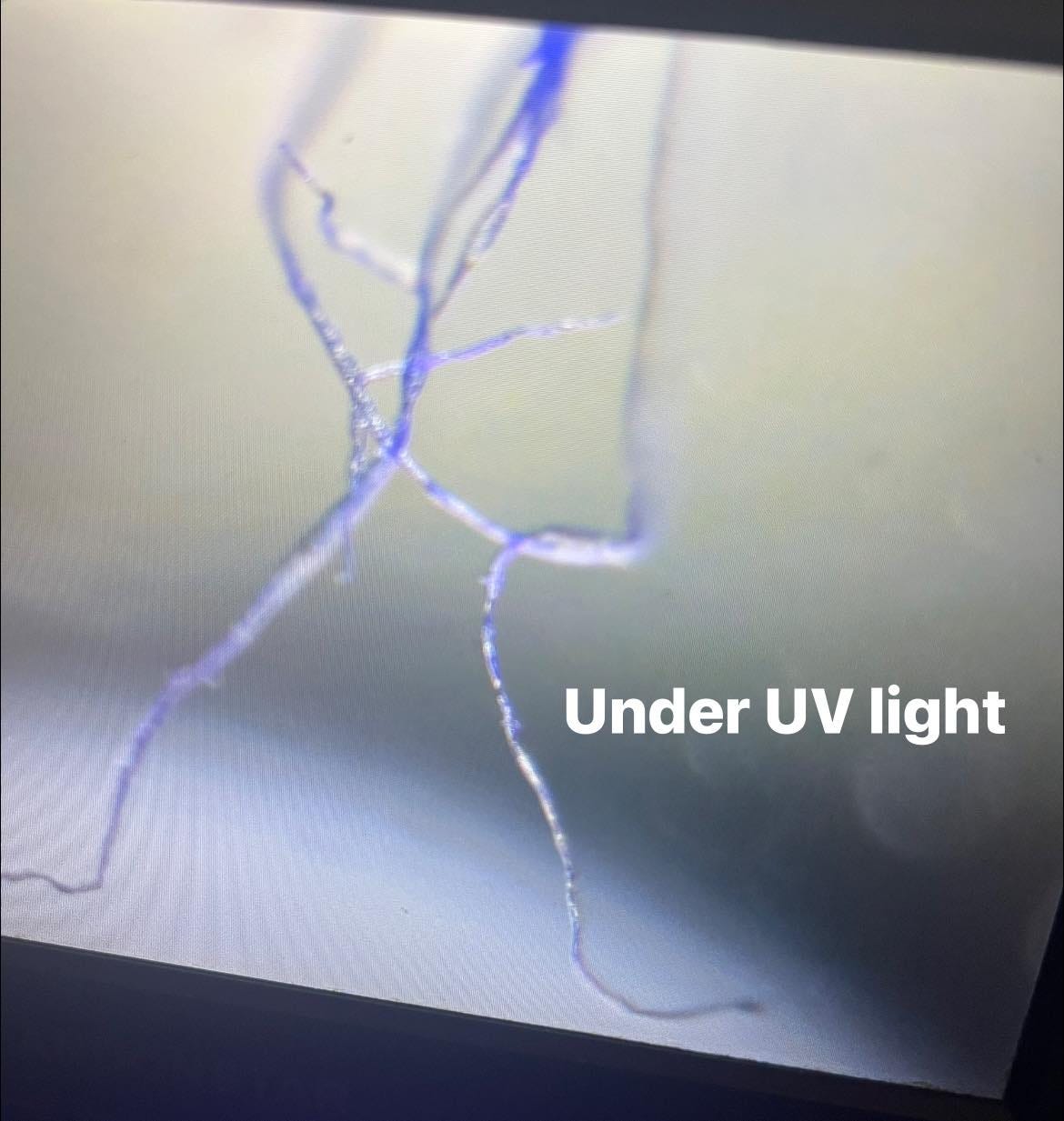May be an image of xray and text that says 'Under UV light' May be an image of xray and text that says 'Under UV light'