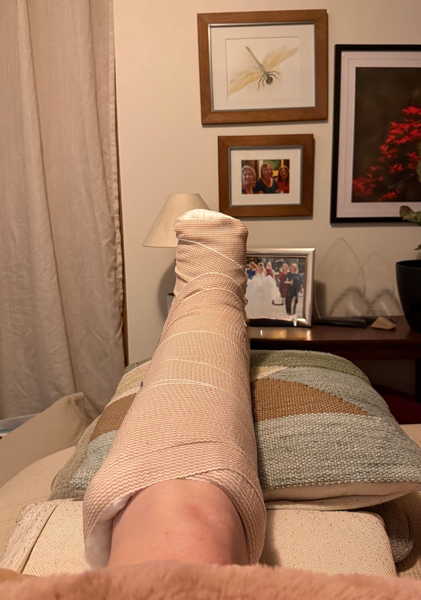 A woman's left leg, wrapped in a splint, is propped up on pillows on the bed. A woman's left leg, wrapped in a splint, is propped up on pillows on the bed.