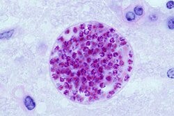 Toxoplasma gondii - Wikipedia
