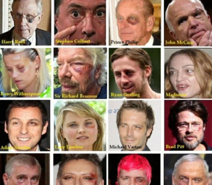 Could Wounded Eyes Among High-Profile Figures Be Signs of Dark Allegiances?