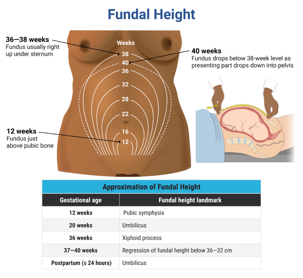 Rapid Review: Fundal Height - RoshReview.com