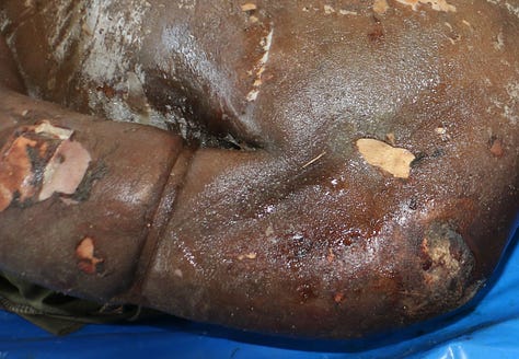 Gaza authorities publish shocking images of Israeli abuse as dozens of unidentified bodies are buried - Palestine Will Be Free