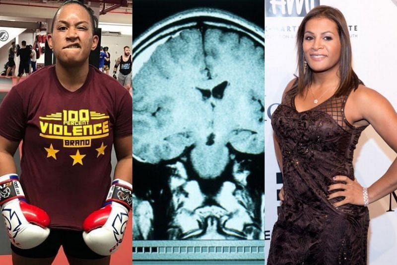 When transgender fighter Fallon Fox broke her opponent's skull in MMA fight