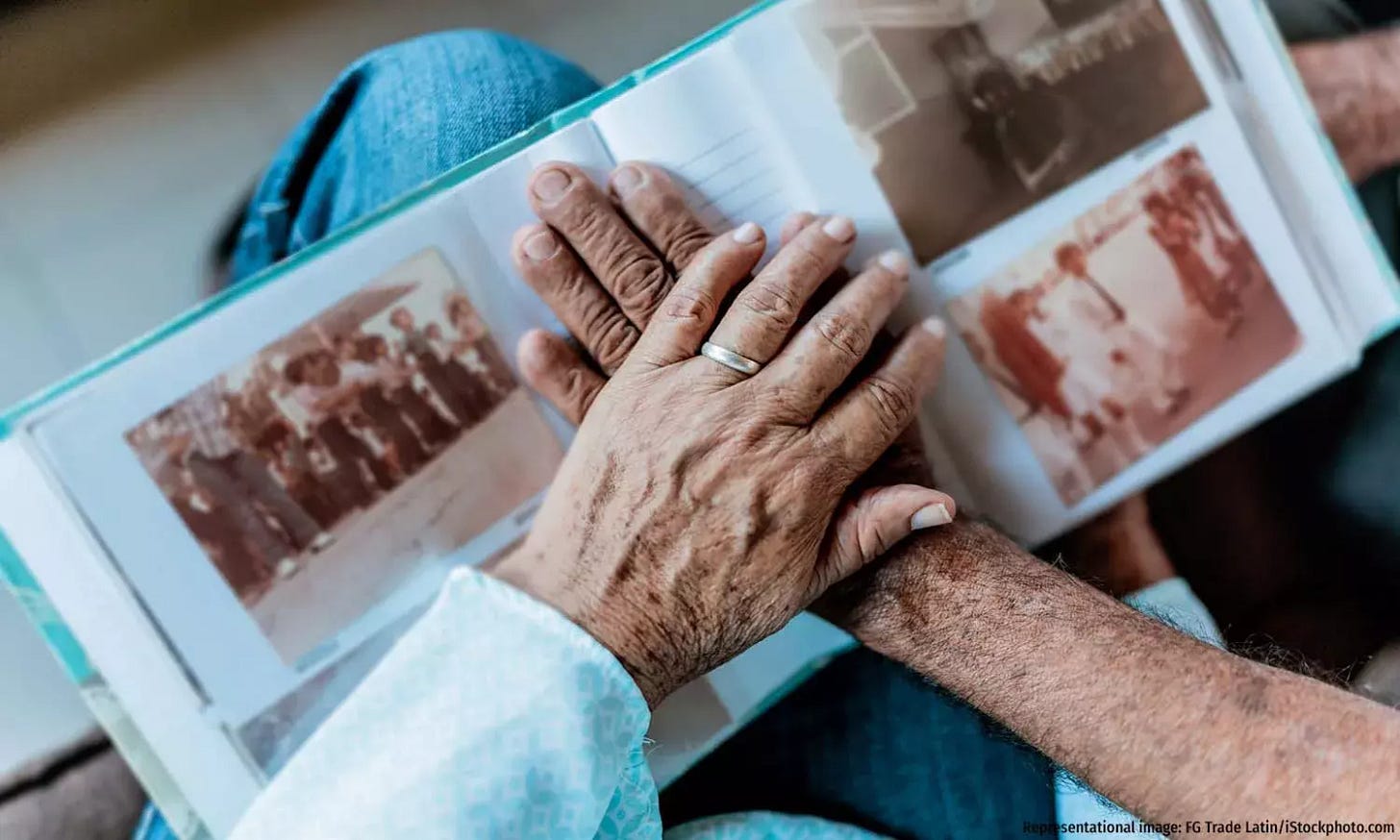 How Alzheimer’s Care Is Largely Palliative How Alzheimer’s Care Is Largely Palliative