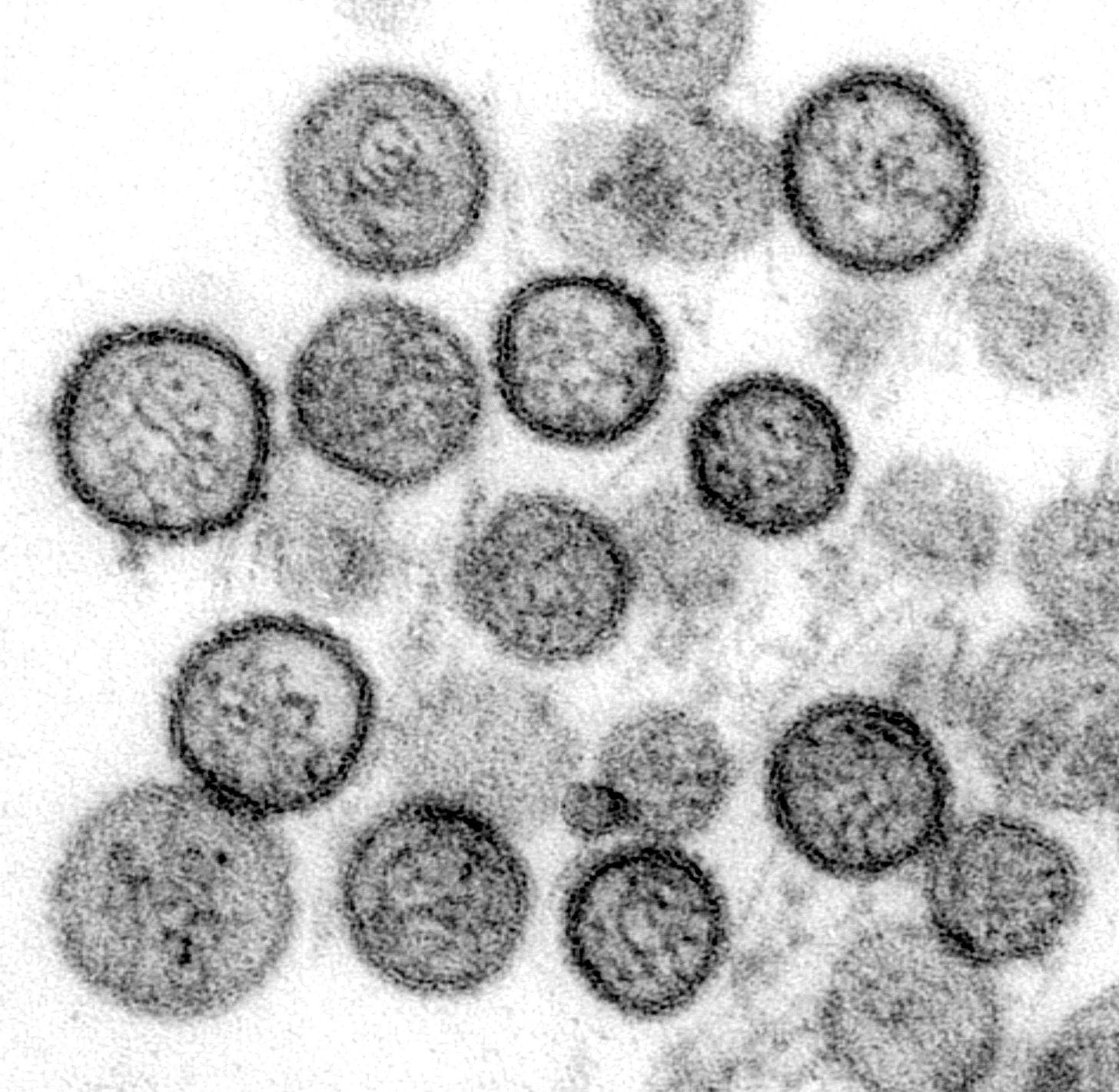 Free picture: transmission, electron micrograph, sin, nombre, virus ... Free picture: transmission, electron micrograph, sin, nombre, virus ...