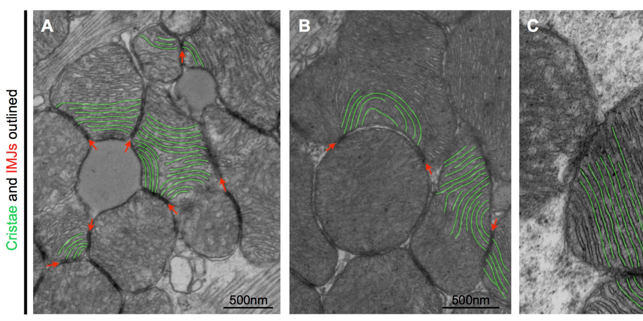 Discovering How Mitochondria Communicate