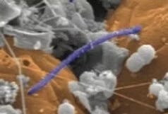  The Microbe That Changed How I See the World, Candidatus Desulforudis audaxviator,