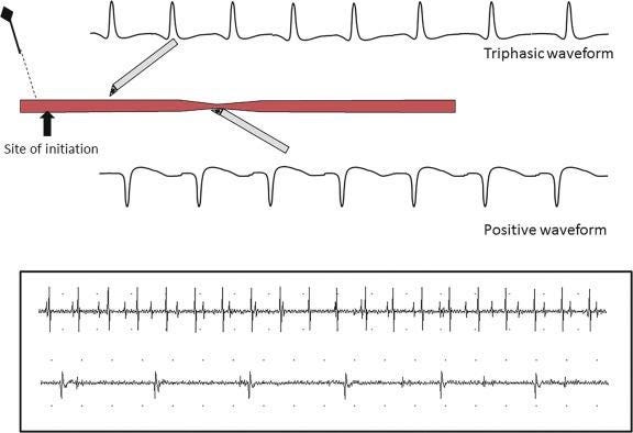 Fig. 17.6