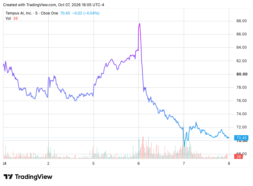 TradingView chart TradingView chart