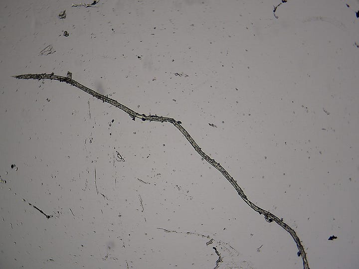 And More 'Things' in urine samples