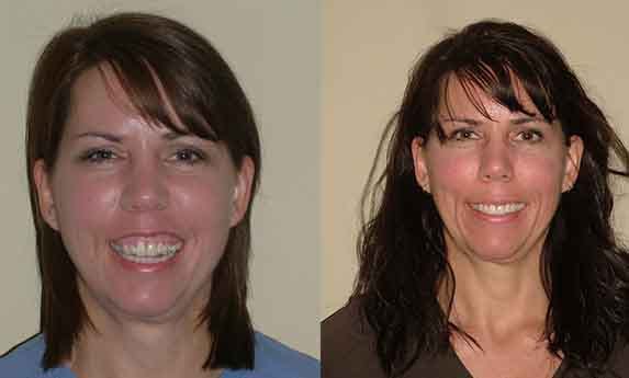 DNA Appliance in Maryland - Holistic Dental Solutions