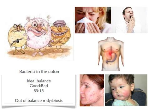The ideal balance of bacteria in your gut is about 85 percent beneficial and 15 percent harmful ...