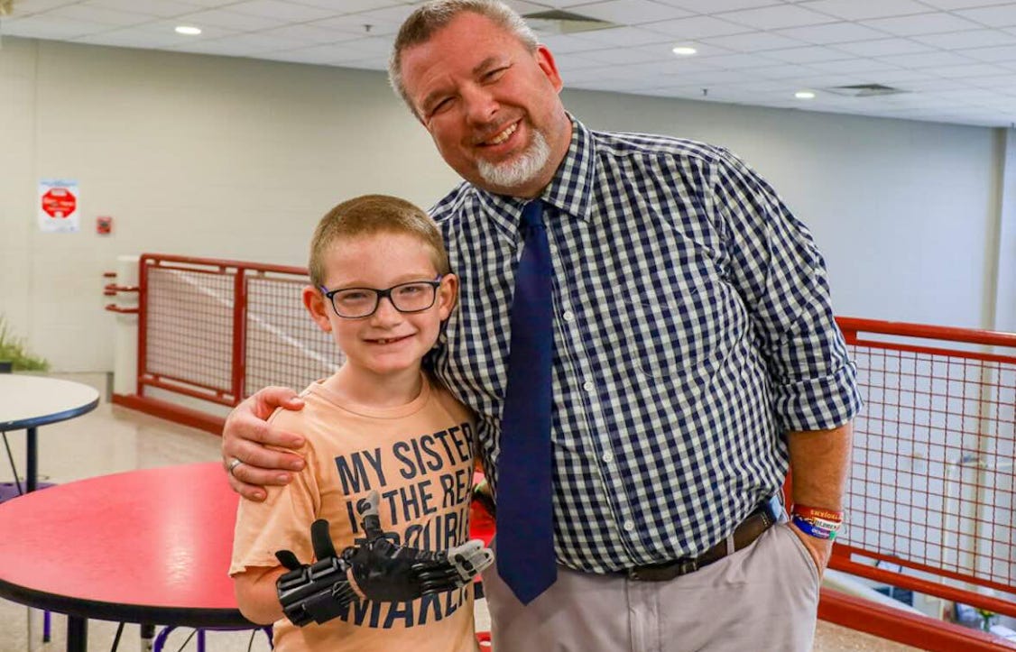 Jackson, 10 ans, découvre sa main imprimée en 3D grâce à son professeur Jackson, 10 ans, découvre sa main imprimée en 3D grâce à son professeur