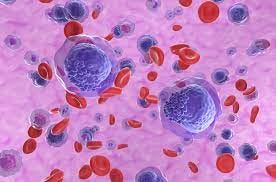 Blood cancers - Haematology | NHS Fife