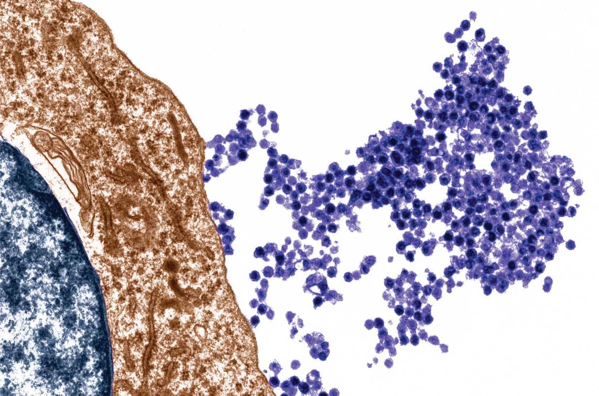 Epstein-Barr virus emerging from a B cell