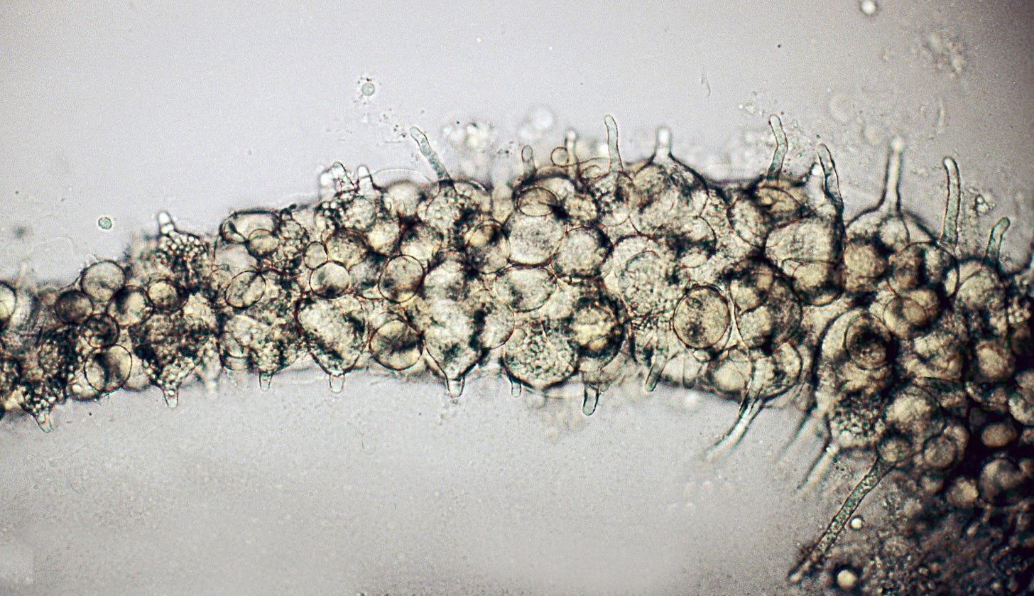 Catenaria anguillulae - massive infection of nema Catenaria anguillulae - massive infection of nema