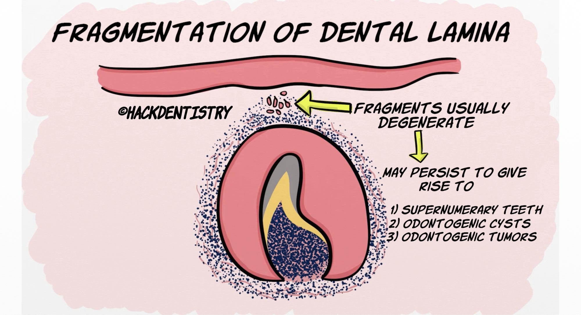 Development and growth of teeth Part II: Bell stage and root formation ...