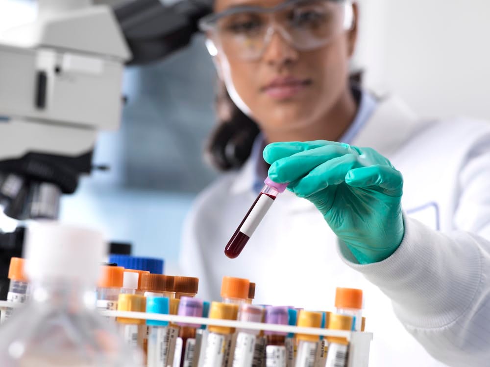 Aging Lab Test Functional & Anti-Aging Laboratory Testing