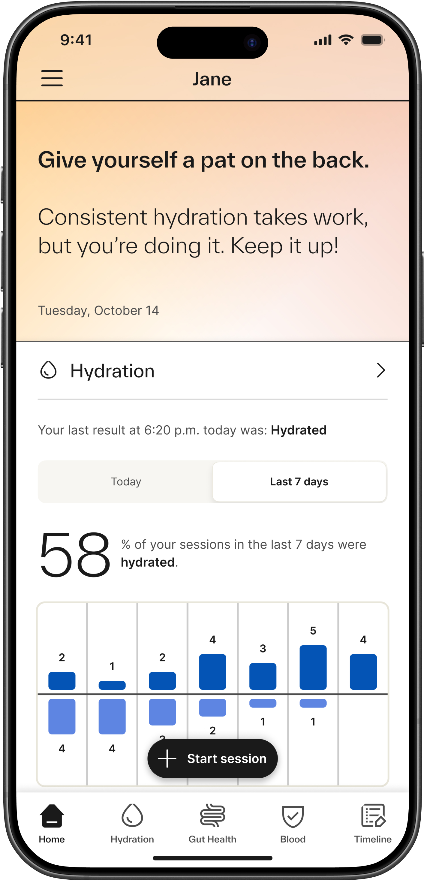 Insights Section iPhone