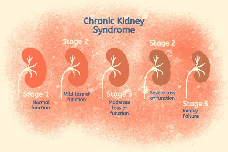 Chronic Kidney Disease