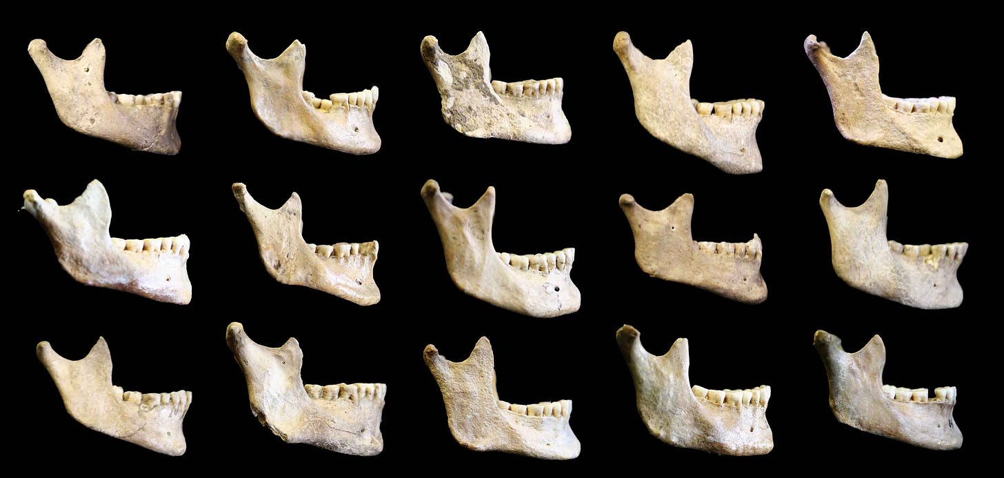 Fifteen mandibles seen from right lateral view, with varying chin prominence