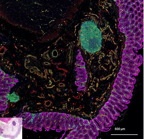 Fluorescent microscopy image of intestinal wall with insert of a typical histology section, for comparison. Fluorescent microscopy image of intestinal wall with insert of a typical histology section, for comparison.