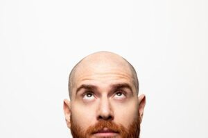 bald man