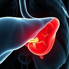 Classic Liver/Gallbladder Flush Protocol