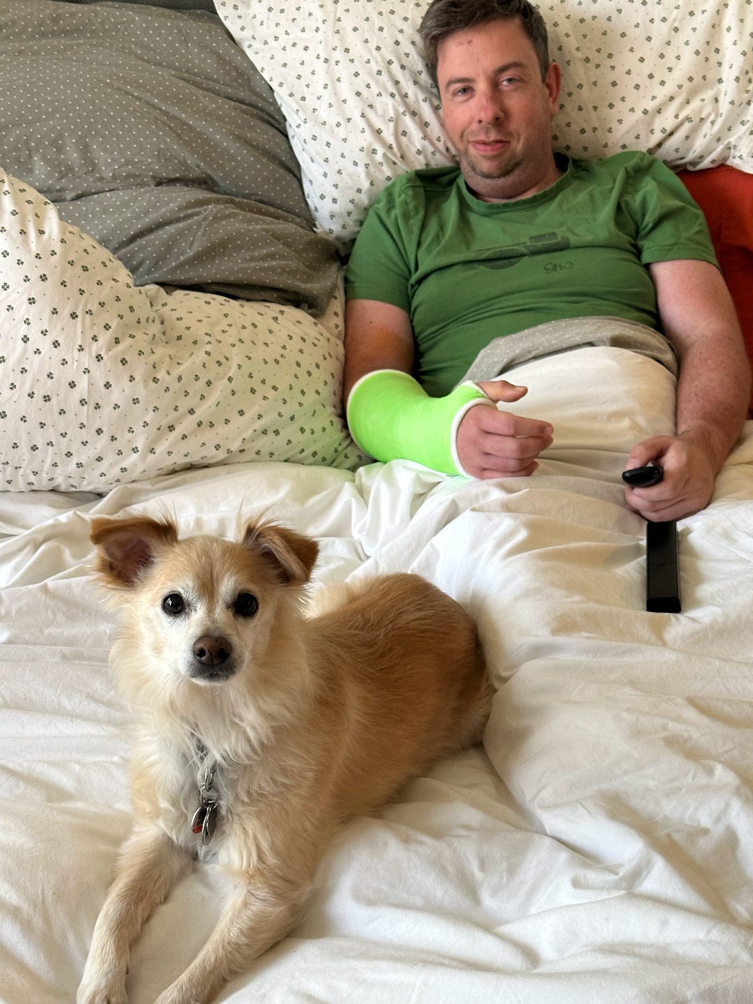 Photo of Everett Wilson in bed with his dog Cooper. Everett is wearing a bright green cast on his forearm.