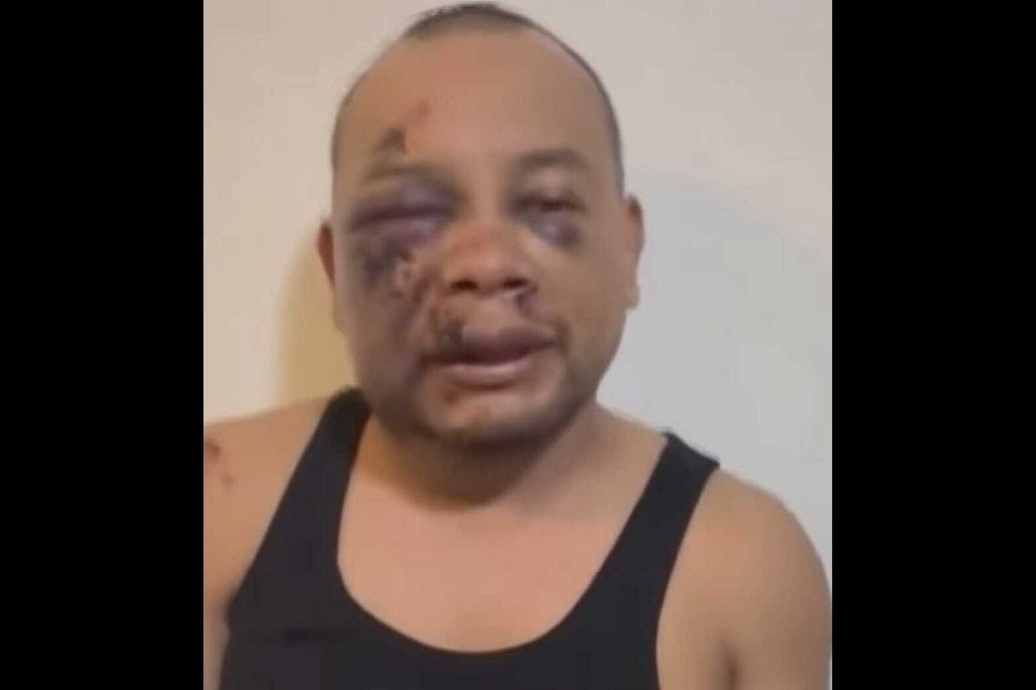ICE agents reportedly injure man in Arlington, prompting outcry from officials | ARLnow.com ICE agents reportedly injure man in Arlington, prompting outcry from officials | ARLnow.com
