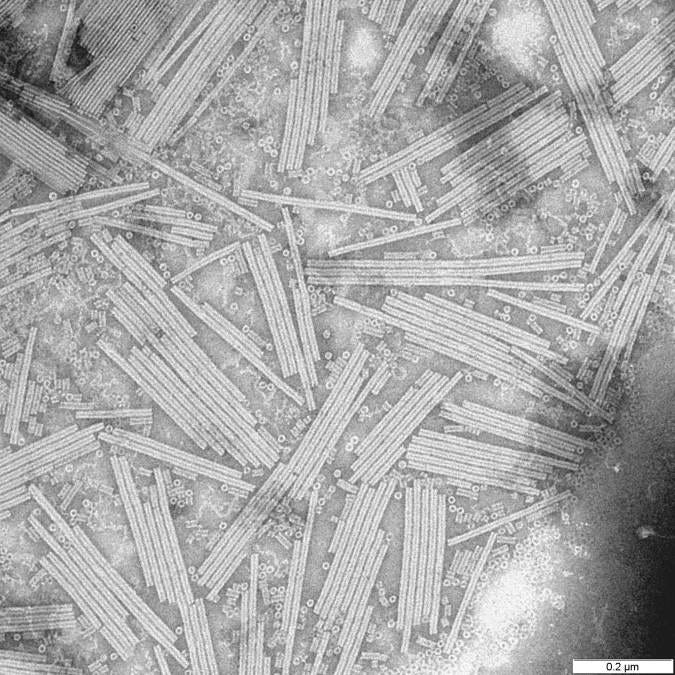 Electron micrograph of rod-shaped tobacco mosaic virus particles Electron micrograph of rod-shaped tobacco mosaic virus particles