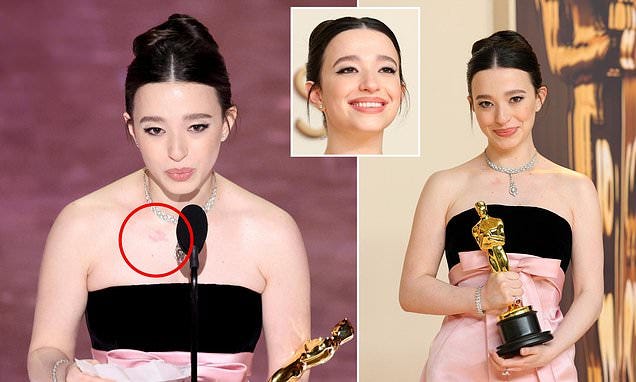 Eagle-eyed fans spot unusual mark on Oscar winner Mikey Madison's body that  flares up when she's nervous | Daily Mail Online