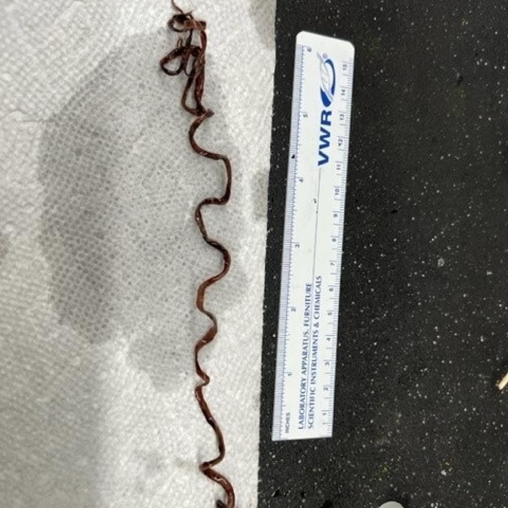 Clot 2 Alabama News