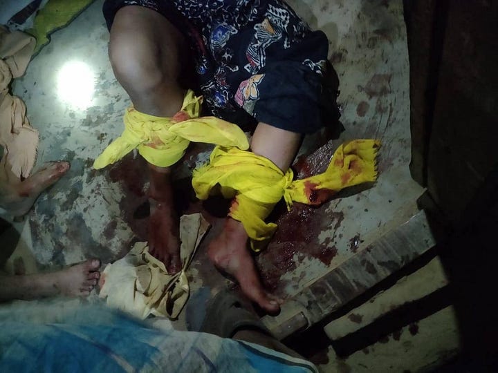 Vionece in Rohingya camp 4