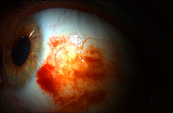 No photo description available.