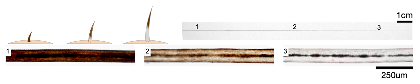 This figure shows a color transition within a single strand of hair where it was originally brown and then began turning grey.