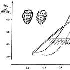 Research classics: Een theoretisch verklaring voor de 'anaerobe drempel'.