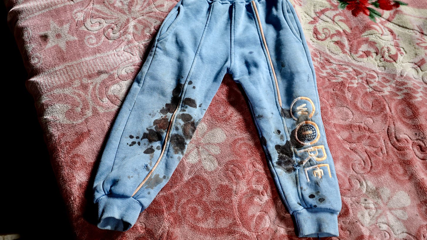 'Burning with cigarette butts': 22-month-old Jawad’s mother recounts his torture by Israeli forces - Palestine Will Be Free