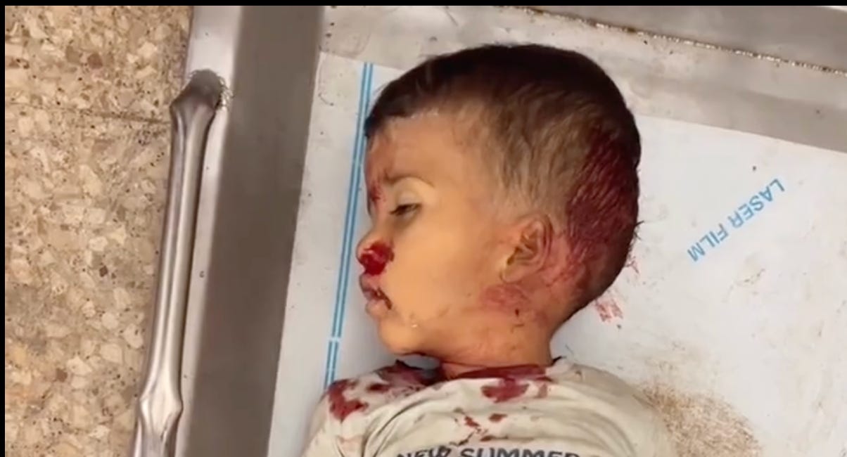 🚨 🎥 I Am Going to Force You to See What Israel and the United States Did to Gaza’s Children Today